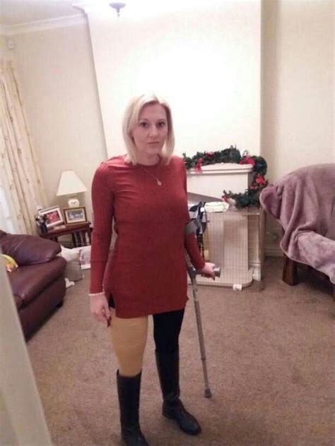 Rak Hobbling Around The House With A Crutch And Prosthetic Limb The
