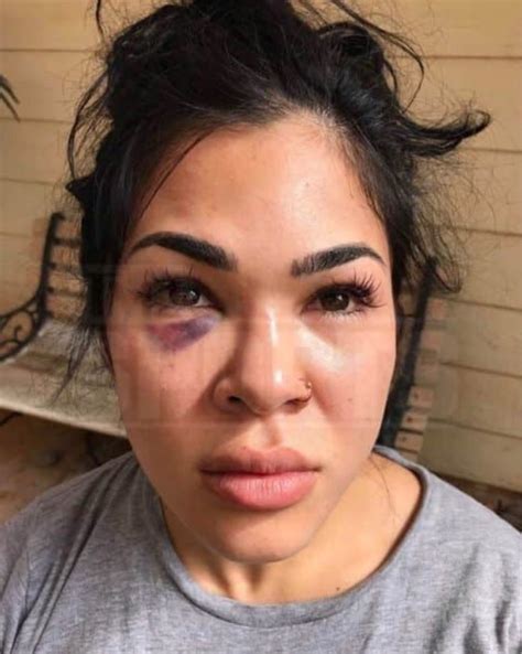 Why Ufc Fighter Rachael Ostovichs Husband Will Get No Jail Time For