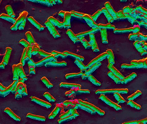Clostridium Perfringens Photograph By Meckesottawa Pixels
