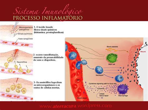 Alteracoes Celulares Benignas Reativas Ou Reparativas Inflamação Microbiologia