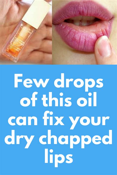 few drops of this oil can fix your dry chapped lips this article describes in detail about