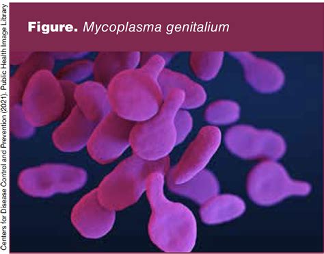 Clinical Presentation Diagnosis And Management Of Mycoplasma