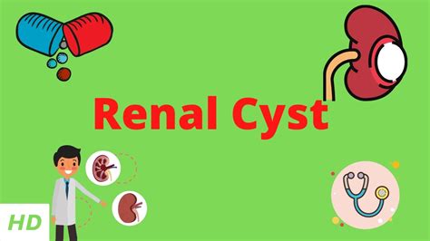 Renal Cyst Causes Signs And Symptoms Diagnosis And Treatment Youtube