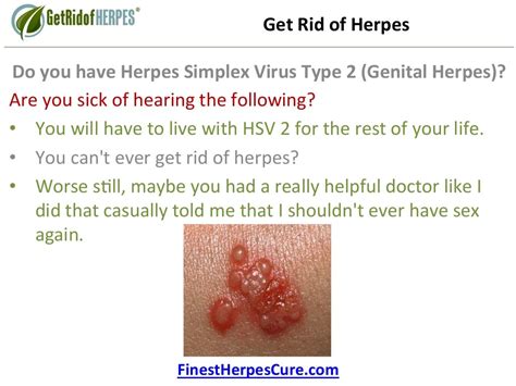 Herpes Lips