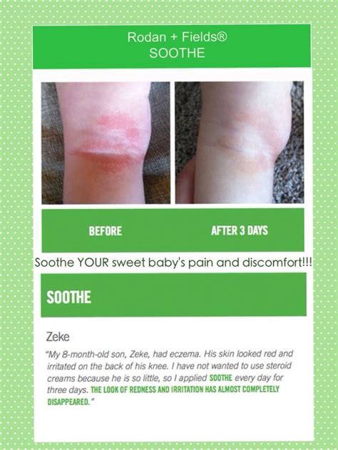 Check Out These Amazing Results Using Rodan And Fields Soothe Regimen
