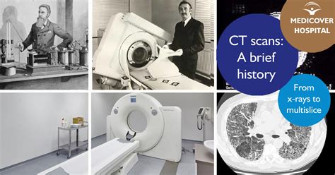 History Of Ct Scan H Medical