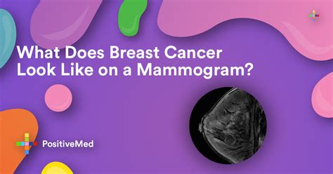 What Does Breast Cancer Look Like On A Mammogram Positivemed