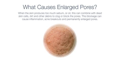 How To Reduce The Appearance Of Enlarged Pores Skinbetter Science®