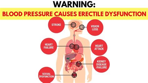 Causes Of Erectile Dysfunction With High Blood Pressure Medicines