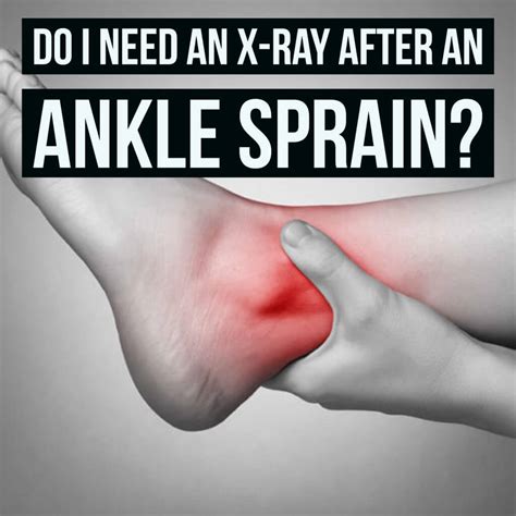 These are the common causes of foot pain and what you need to do about them. Do I Need an X-Ray After an Ankle Sprain? | The Prehab Guys