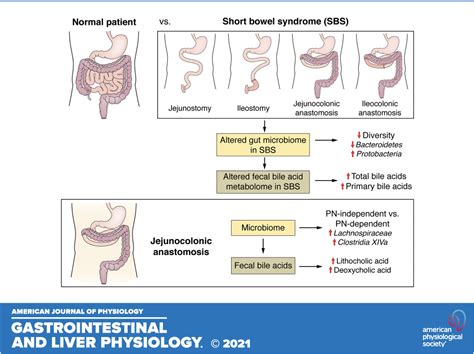 Fecal Microbiome And Bile Acid Metabolome In Adult Short Bowel Syndrome