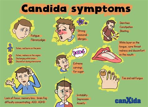 Signs Symptoms Of Candida Candida Symptoms Candida Candida Infection