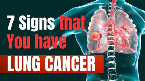 7 Early Warning Signs Of Lung Cancer You Shouldnt Ignore Warnings