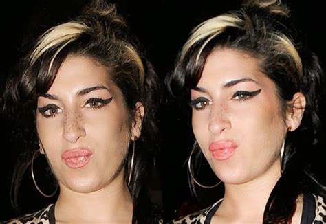 Did Amy Winehouse Have Plastic Surgery Before And After Pictures