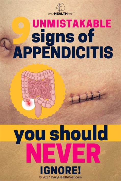 9 Signs Of Appendicitis You Probably Didnt Know About Info You