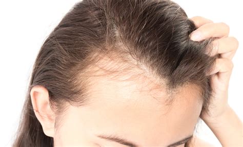 Tight braids tight pony tails pulling of hair in same. How to Deal With Hair Shedding in the Fall —Why Is My Hair ...