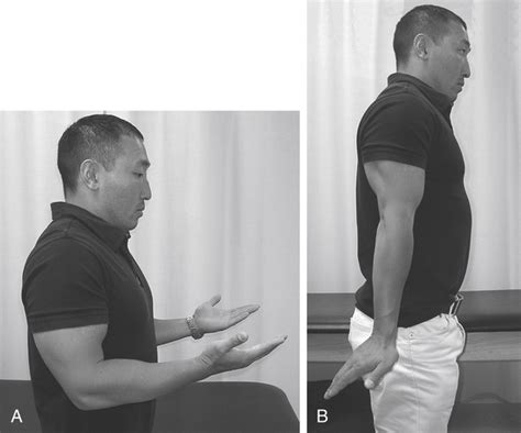 Common Shoulder Diagnoses Musculoskeletal Key