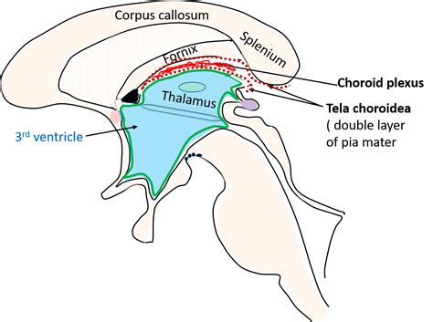 Third Ventricle Location Boundaries Recesses And Choroid Plexus