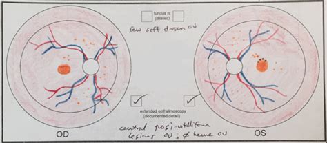 My Efforts As An Artist Learning To Draw The Retina — Matt Weed Md