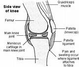 Images of Torn Meniscus Home Remedies