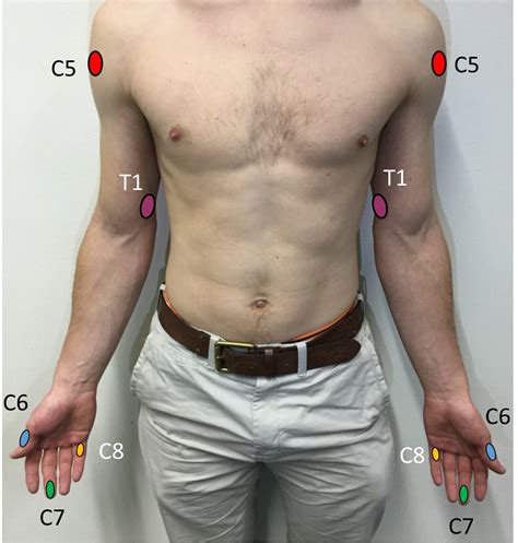 Dermatomes Upper Limb Peripheral Neurological Examination Cleaning Motivation Medical Kulturaupice