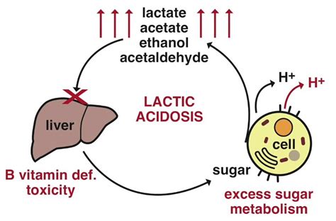 Lactic Acidosis Causes Symptoms Lactic Acidosis Treatment
