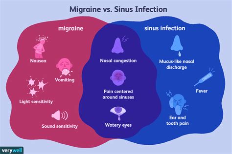 Migraine And Sinus Headache How To Tell The Difference
