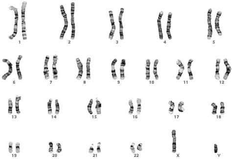 3 2 Chromosomes The Biology Classroom