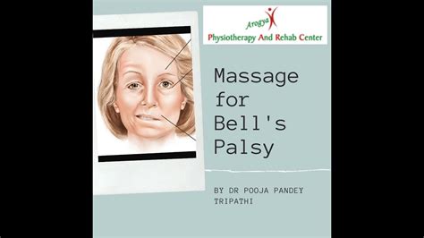 Facial Massage Technique In Bells Palsy And Facial Palsy Cases Youtube