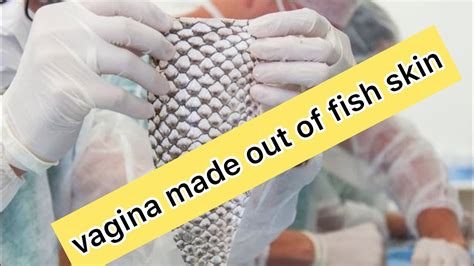 Trans Woman First In World To Get Vagina Made Out Of Fish Skin