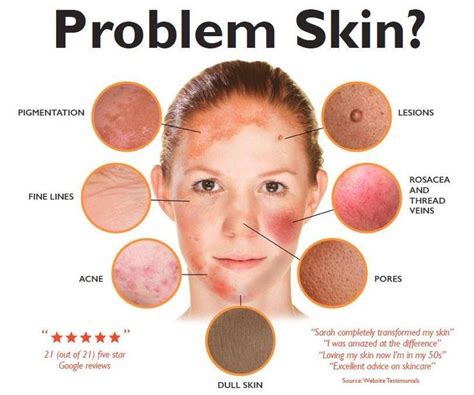 Aesthetic Dermatology Facial Aesthetics Dull Skin Beauty Hacks