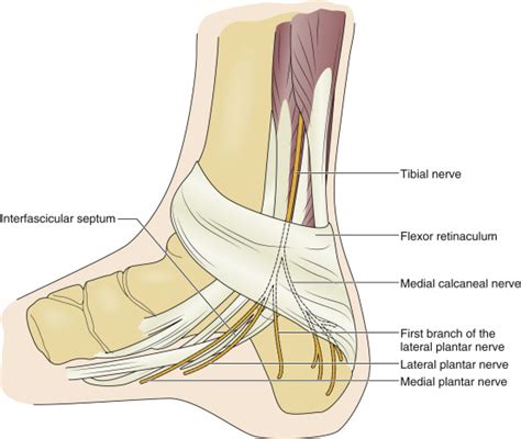 Tibial Neuropathy Tarsal Tunnel Syndrome Musculoskeletal Key