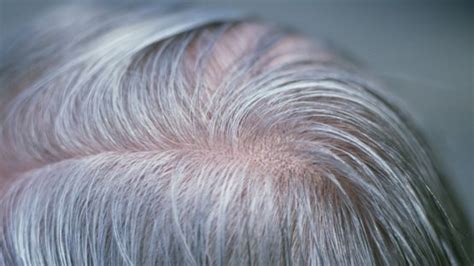 scientists discover grey hair gene international inside