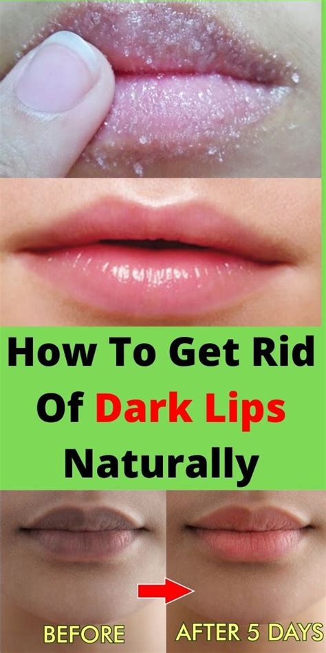 proven ways to get rid of dark lips naturally dark lips chapped lips remedy pink lips
