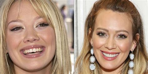 10 celebrities with veneers celebrities who had major teeth transformations