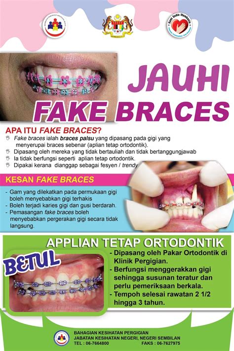 Blog Rasmi Bahagian Kesihatan Pergigian Negeri Sembilan Jauhi Fake Braces