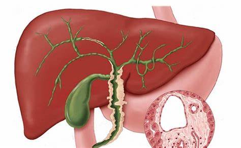 Печень желчный пузырь диету Primary Biliary Cholangitis Histology Primary Biliary Cholangitis Histology Печень желчный пузырь диету