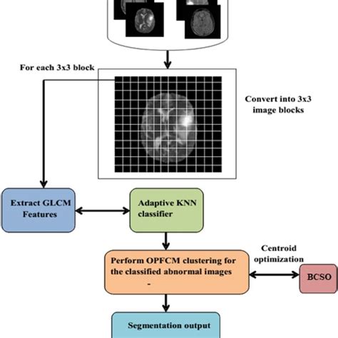 Mri Brain Tumor Detection Using Optimal Possibilistic Fuzzy C Means