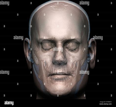 Human Head 3d Ct Scan Stock Photo Alamy