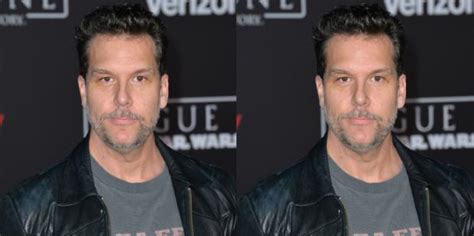did dane cook get plastic surgery check out these before and after photos cooncel