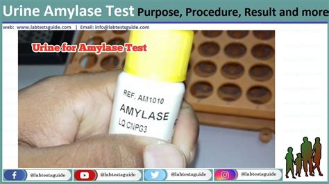 Amylase Test Procedure Lab Tests Guide