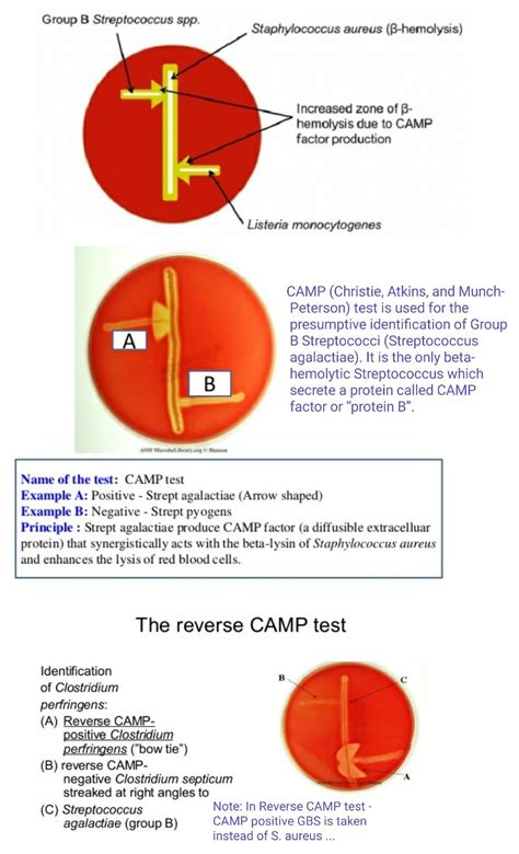 Camp And Reverse Camp Test Streptococcus Agalactiae Listeria Clostridium Perfringes