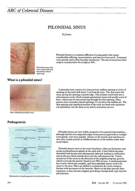 Abc Of Colorectal Diseases Pilonidal Sinus The Bmj