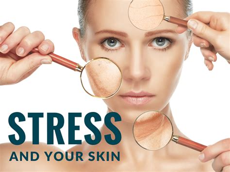 Stress And Your Skin