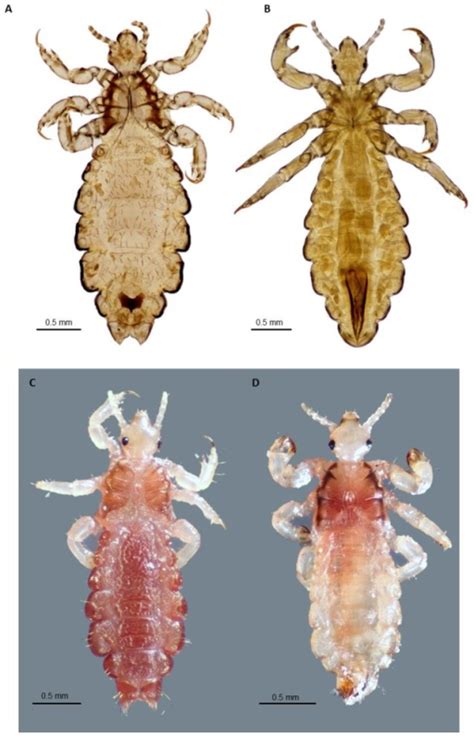 Adult Body Louse And Head Licea Ventral View Of Slide Open I