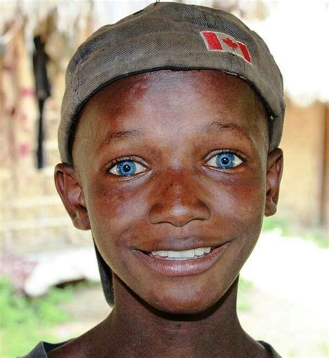 Blue Eyed African Boy From Sierra Leone People With Blue Eyes Black