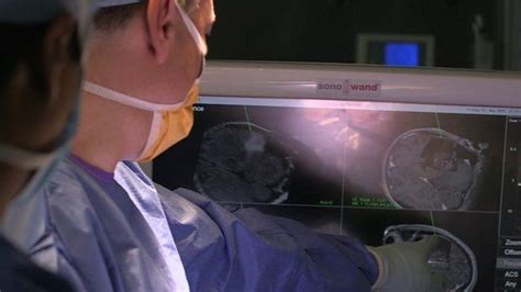 Surgical Smart Knife Identifies Brain Tumours Bbc News