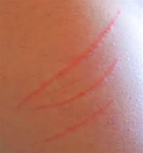 Albums 103 Wallpaper Pictures Of Dog Scratches On Humans Superb
