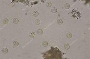 Entamoeba coli cysts stage in stool exam. — Stock Photo © toeytoey ...