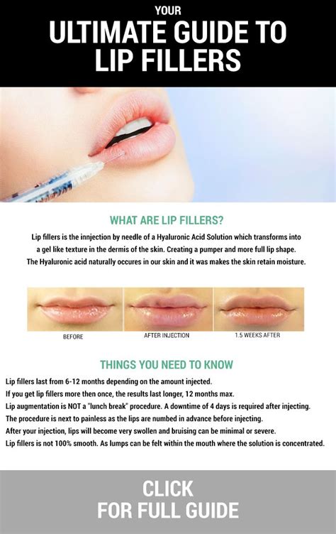 Your Ultimate Guide To Lip Fillers Lips Cosmetics And Learning